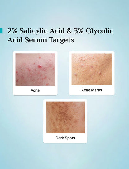 Pilgrim Anti Acne Serum With Salicylic & Glycolic Acid For Dark Spots